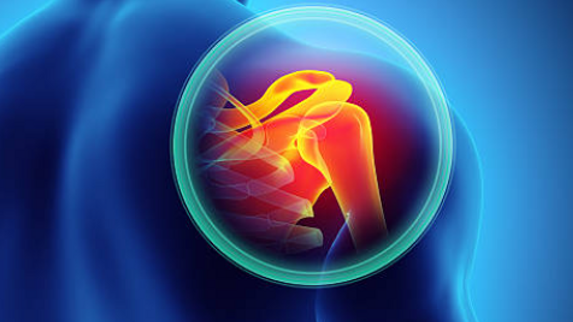 Ricostruzione danni persone